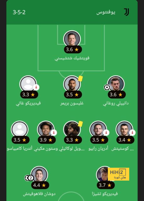 هل يستبعده الاتحاد من المونديال؟ .. الكشف عن مدة غياب كريم بنزيما عن الملاعب | 